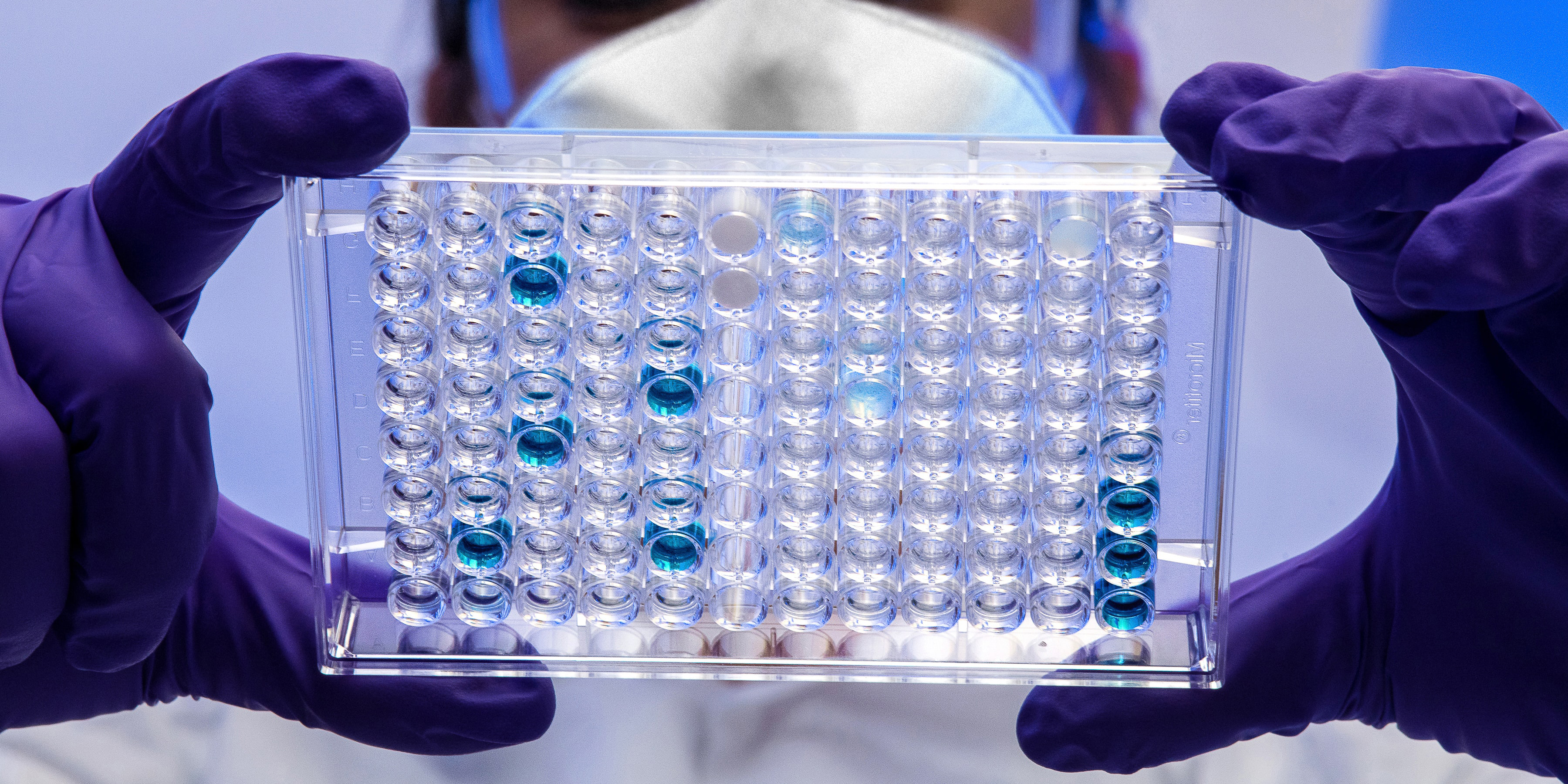 La gestion des déchets en laboratoire : les bonnes pratiques à adopter